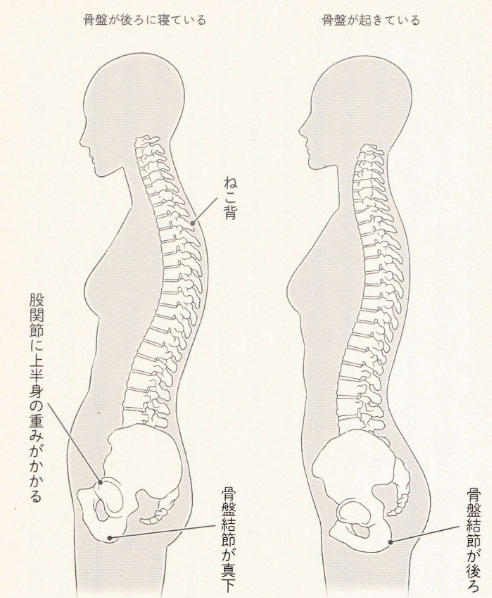 女性特有の腰痛を和らげる方法【骨盤後傾・左右お尻腰痛改善】